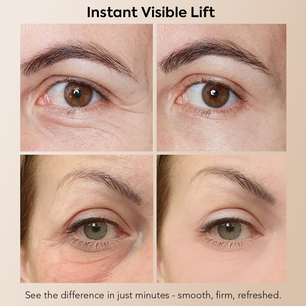 Instant Eye Tightener