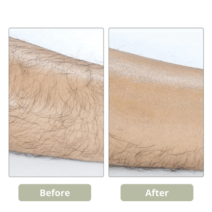 GET SMOOTH PAINLESS! - CRYSTAL HAIR ERASER