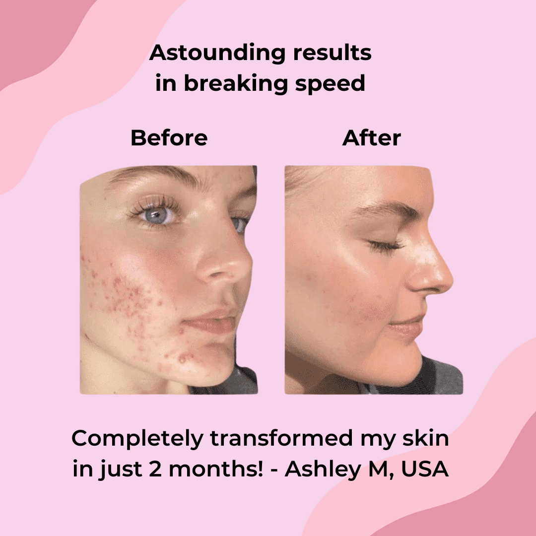 Turmeric Kojic Acid Cleansing Pads