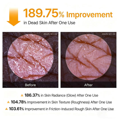 🌸 New! Peeling Shot Keratin Care Kojic Acid Turmeric Spray