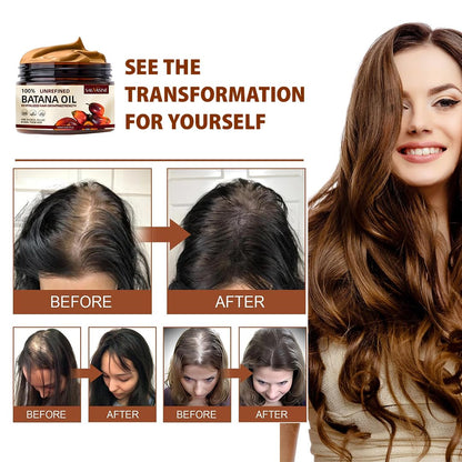 Batana Oil for Hair Growth – 100% Raw, Pure, Organic & Dr. Sebi Batana Oil – Unrefined Hair Treatment from Honduras – Boosts Thickness, Prevents Hair Loss for Men & Women – 4.05 Oz