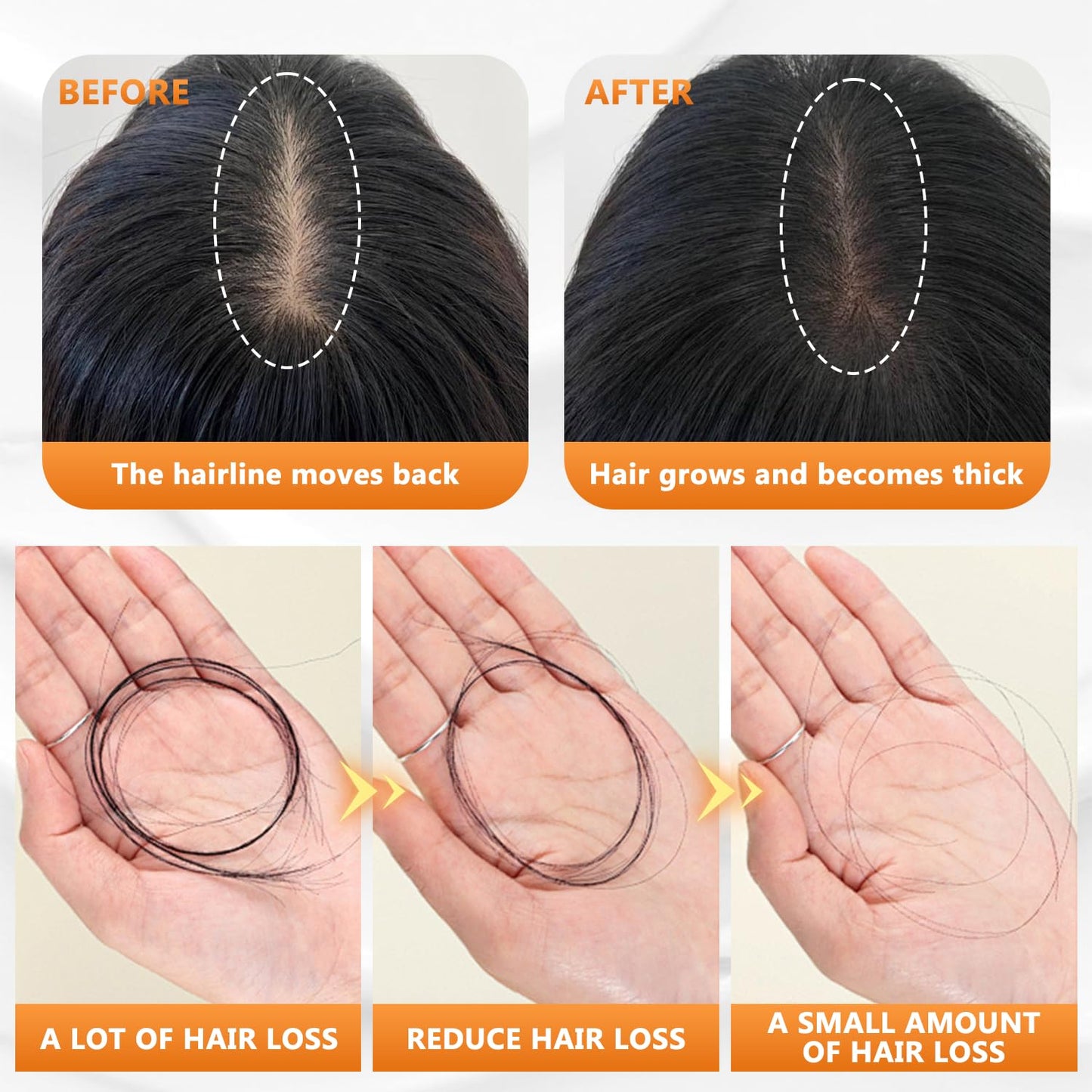 Anti-Hair Fall Hair Loss Shampoo