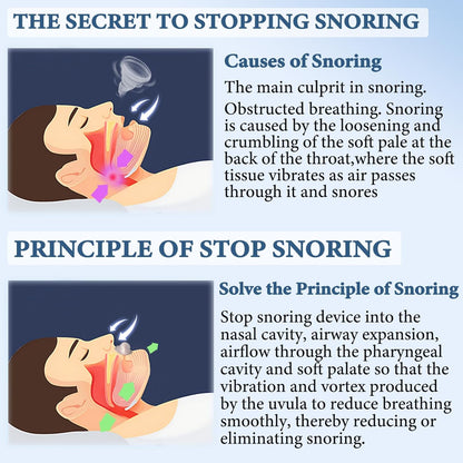 SleepEase Mouthguard