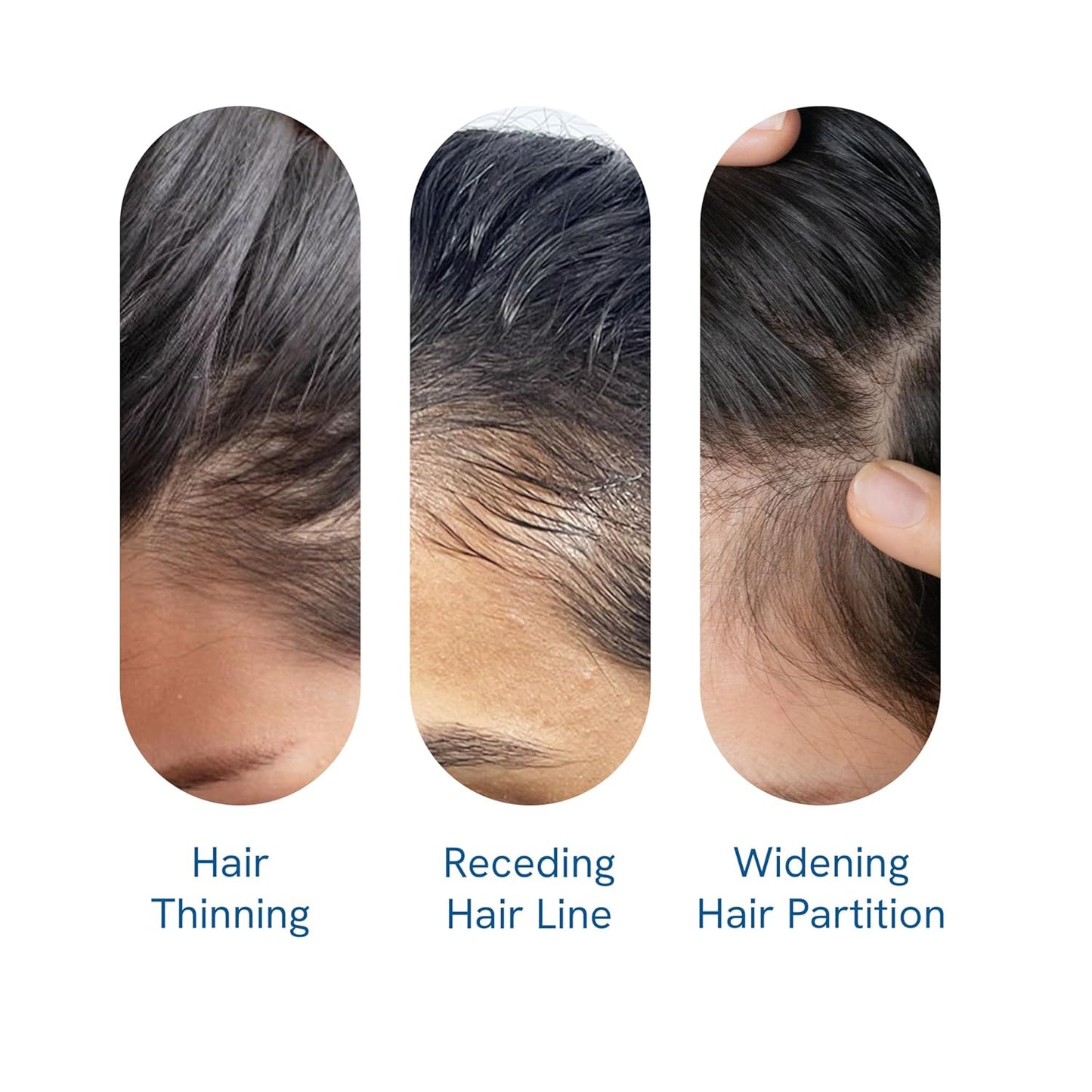 Hair Growth Roll-On