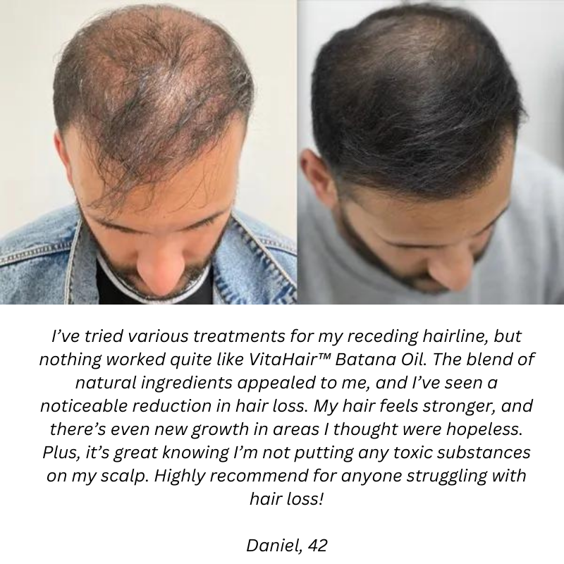 Natural Hair Growth Oil v3.0