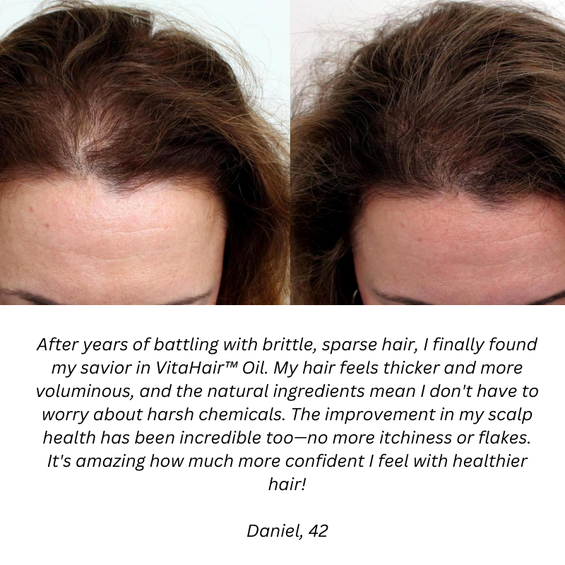 Natural Hair Growth Oil v3.0