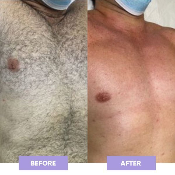 GET SMOOTH PAINLESS! - CRYSTAL HAIR ERASER